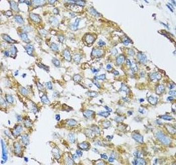 SLC25A13 Rabbit Polyclonal Antibody