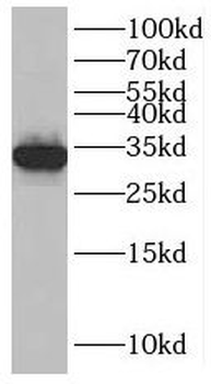 SLC25A34 Rabbit Polyclonal Antibody