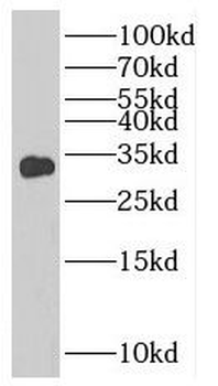 SLC25A4 Antibody