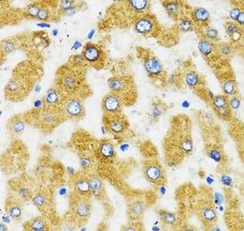 SLC27A2 Rabbit Polyclonal Antibody