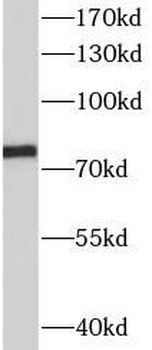 SLC34A2 Antibody