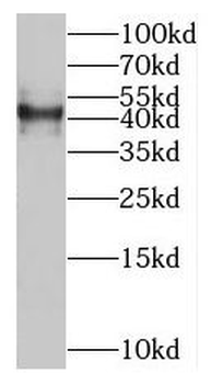 SLC35F2 Antibody