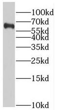SLC37A2 Rabbit Polyclonal Antibody