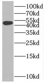 SLC37A4 Rabbit Polyclonal Antibody