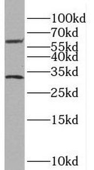 SLC47A1 Rabbit Polyclonal Antibody