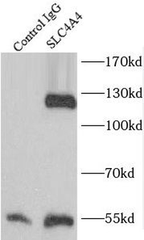 SLC4A4 Rabbit Polyclonal Antibody
