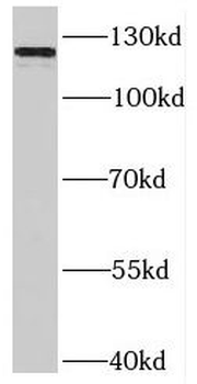 SLITRK3 Rabbit Polyclonal Antibody