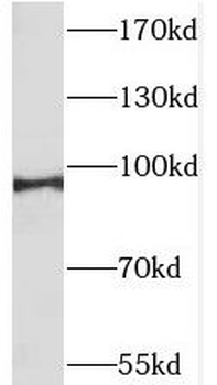 SLITRK4 Rabbit Polyclonal Antibody