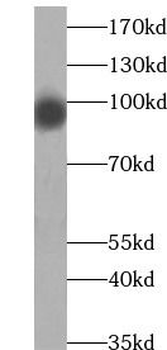 SLITRK6 Antibody