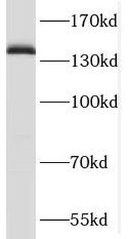 SLTM Antibody