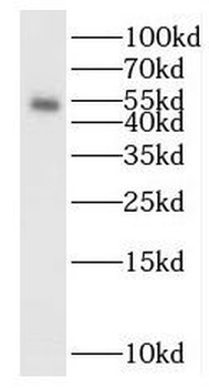SMAD5 Rabbit Polyclonal Antibody
