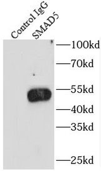 SMAD5 Rabbit Polyclonal Antibody