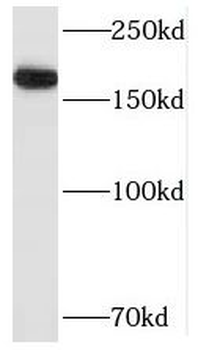 SMARCA5 Rabbit Polyclonal Antibody