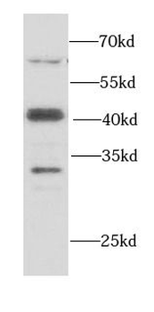 SMARCB1 Rabbit Polyclonal Antibody