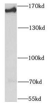 SMARCC1 Antibody