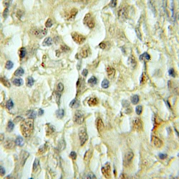 SMARCD1 Antibody