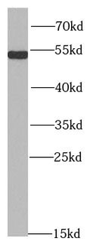 SMARCE1 Rabbit Polyclonal Antibody