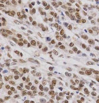 SMARCE1 Rabbit Polyclonal Antibody