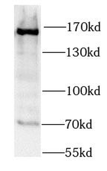 SMC1A Rabbit Polyclonal Antibody
