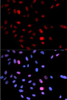 SMC1A Rabbit Polyclonal Antibody