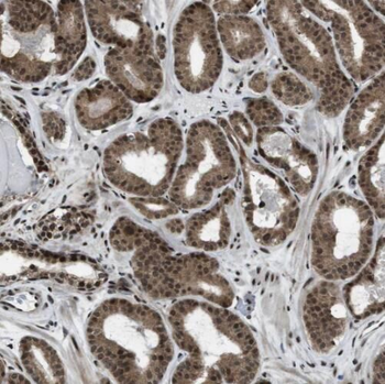 SMC4 Rabbit Polyclonal Antibody