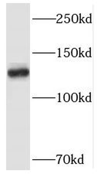 SMC5 Rabbit Polyclonal Antibody