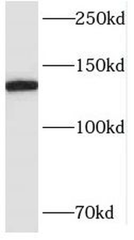 SMC6 Rabbit Polyclonal Antibody
