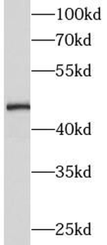 MIEF2 Rabbit Polyclonal Antibody