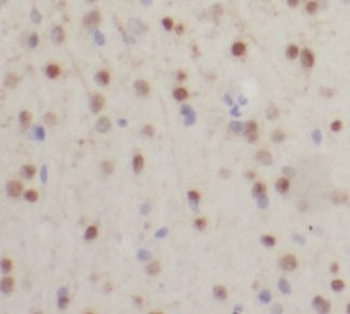 SMN1 Rabbit Polyclonal Antibody