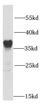 SMN1 Rabbit Polyclonal Antibody