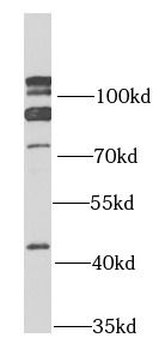 SMO Rabbit Polyclonal Antibody