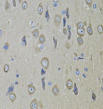 SMO Rabbit Polyclonal Antibody