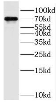SMTNL2 Rabbit Polyclonal Antibody