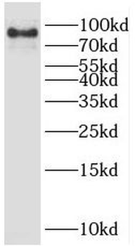 SMURF1 Rabbit Polyclonal Antibody