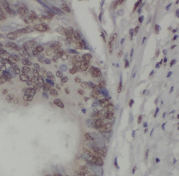 SMURF1 Rabbit Polyclonal Antibody