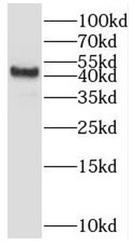 SMYD3 Antibody