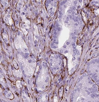 SNAP23 Rabbit Polyclonal Antibody