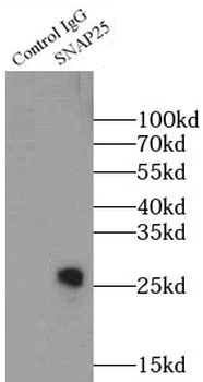 SNAP25 Mouse Monoclonal Antibody