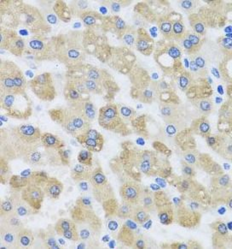 SNAP29 Rabbit Polyclonal Antibody