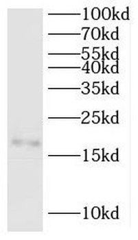 SNAPIN Rabbit Polyclonal Antibody