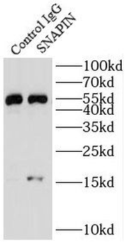 SNAPIN Rabbit Polyclonal Antibody