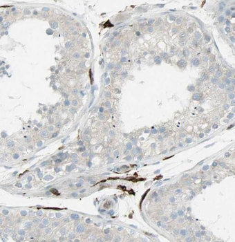 SNAPIN Rabbit Polyclonal Antibody