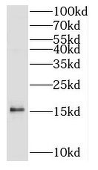 SNCB Rabbit Polyclonal Antibody