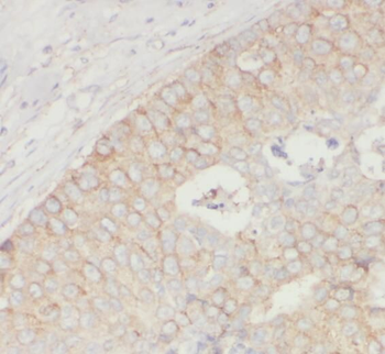SNCB Rabbit Polyclonal Antibody