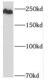 SNRNP200 Antibody