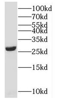 SNRPB Rabbit Polyclonal Antibody