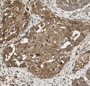 SNRPB Rabbit Polyclonal Antibody