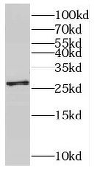 SNRPB2 Rabbit Polyclonal Antibody