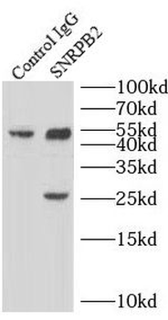 SNRPB2 Rabbit Polyclonal Antibody