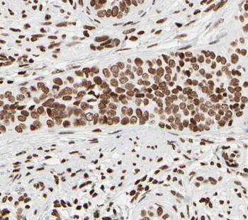 SNRPB2 Rabbit Polyclonal Antibody